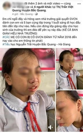 Hình ảnh nữ học sinh lớp 4 Trường Tiểu học Nguyễn Trãi, huyện Bắc Quang (Hà Giang) bị giáo viên tát vào má được người nhà học sinh đưa lên mạng xã hội. Ảnh: TTXVN