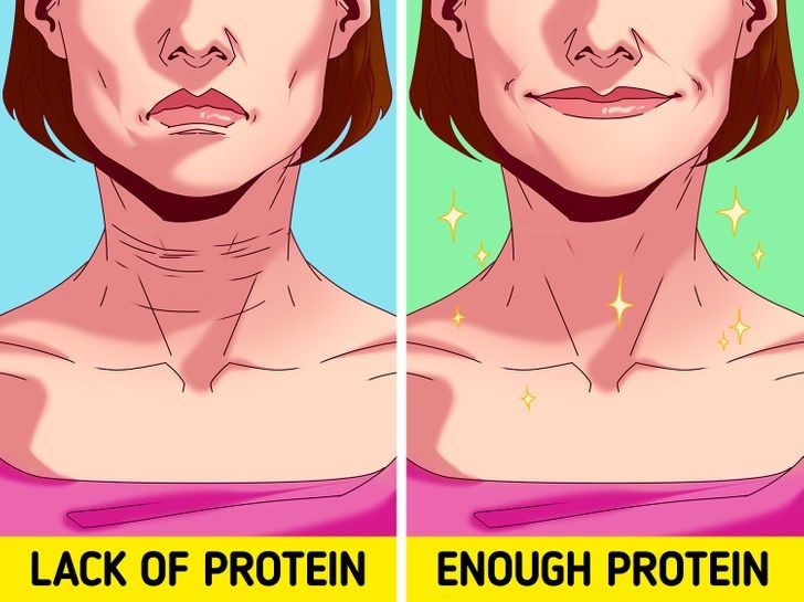Một nghiên cứu chỉ ra rằng, bếu bạn hạn chế lượng calo và ăn ít protein, da của bạn sẽ mất độ đàn hồi, từ đó dẫn đến nhiều nếp nhăn hơn. Ảnh Brightside
