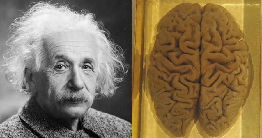 Nhà bác học Albert Eistein và bộ não khiến giới khoa học tò mò của ông.