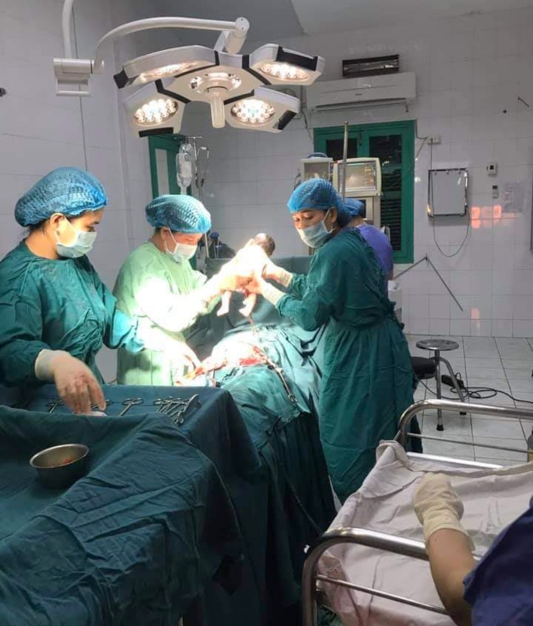 Ê kíp phẫu thuật của Trung tâm Y tế huyện Hướng Hóa mổ đẻ cấp cứu thành công cho sản phụ H.T.A.R. - Ảnh: TTYT Hướng Hóa cung cấp
