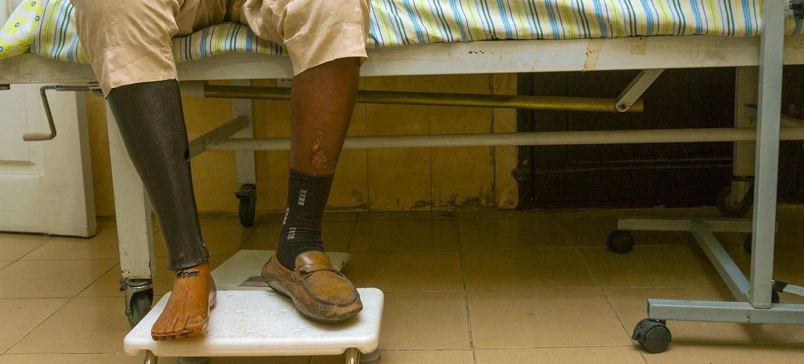 Một người đàn ông 54 tuổi người Nigeria mắc bệnh tiểu đường loại 2 đã phải cắt cụt chân phải.