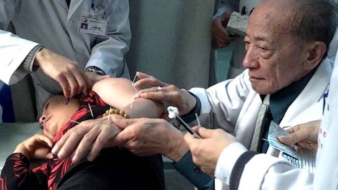 Kĩ  thuật châm cứu của Giáo sư Nguyễn Tài Thu đã cứu chữa cho rất nhiều bệnh nhân