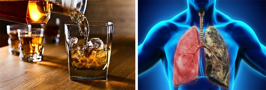 Uống rượu thường xuyên có thể là nguyên nhân gây ung thư phổi. Đồ họa: Hồng Nhật
