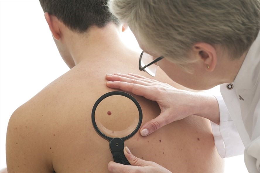 Mọi người cần nhanh chóng thăm khám nếu phát hiện dấu hiệu bất thường trên da. Ảnh minh hoạ: AFP.