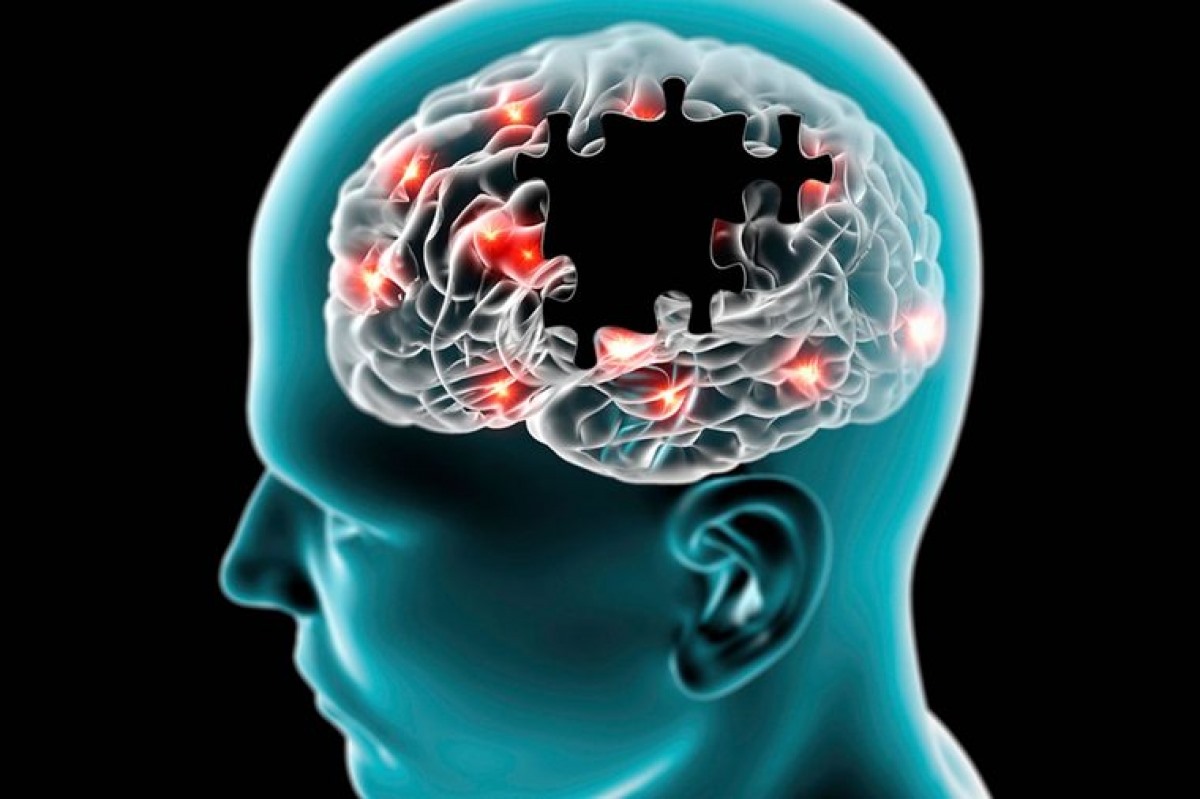 Nguy cơ suy giảm chức năng thần kinh và mất trí nhớ: Những người thuộc nhóm máu AB có nguy cơ suy giảm chức năng thần kinh khi về già cao hơn các nhóm máu còn lại 82%. Tuy nhiên, nhóm máu không phải là yếu tố rủi ro quan trọng nhất của chứng suy giảm thần kinh tuổi già.