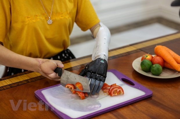 Bạn Lý Thị Khe, 23 tuổi, quê ở Cao Bằng đã sử dụng cánh tay robot được 2 năm nay, giúp cô có thể cầm nắm đồ vật, thái rau củ quả, tự sinh hoạt cá nhân. (Ảnh: Minh Sơn/Vietnam+)