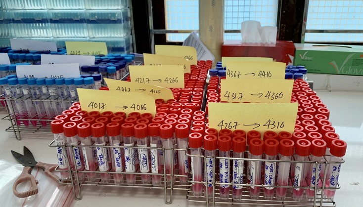 Hơn 9.100 mẫu RT-PCR đã được CDC Quảng Bình thực hiện trong ngày 30-8.
