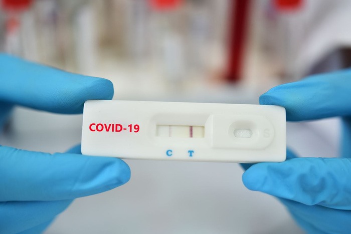 Tràn lan bộ kit test nhanh Covid-19 không rõ nguồn gốc được rao bán trên mạng