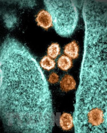 Hình ảnh virus SARS-CoV-2 chụp qua kính hiển vi điện tử tại phòng thí nghiệm ở Hamilton, Montana, Mỹ, ngày 28/6. (Ảnh: AFP/TTXVN)