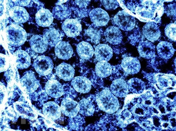 (Hình ảnh do Viện Y tế Quốc gia Mỹ (NIH) cung cấp) Virus SARS-CoV-2 chụp qua kính hiển vi điện tử trên mẫu bệnh phẩm tại phòng thí nghiệm ngày 1/8. (Ảnh: AFP/TTXVN)