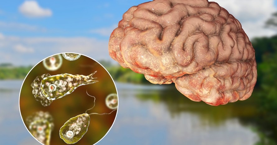 “Amip ăn não” dễ sinh sôi trong môi trường nước ngọt ấm, có thể lây nhiễm vào mũi và xâm nhập lên não người. Ảnh: Newsroom