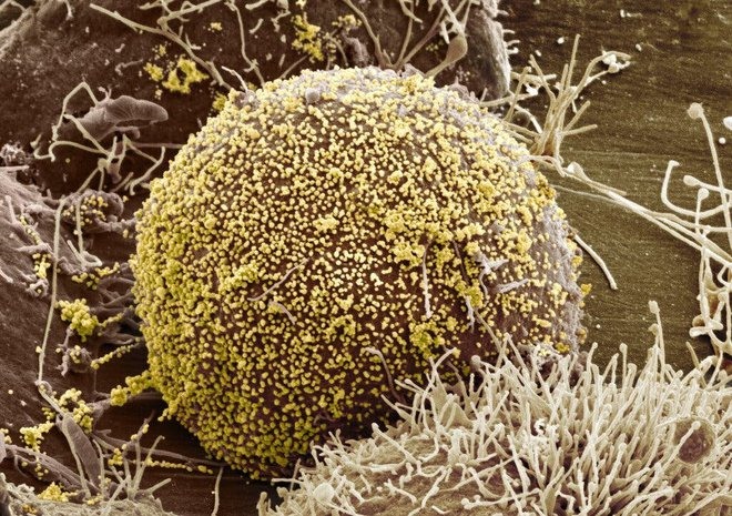 Tế bào HIV.