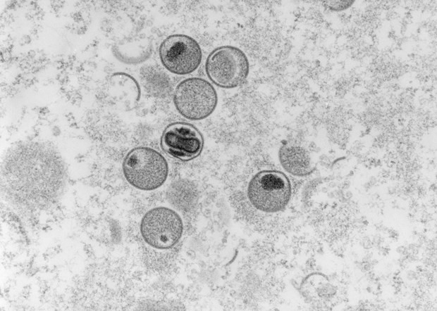Hình ảnh virus đậu mùa khỉ dưới kính hiển vi điện tử tại phòng thí nghiệm thuộc Viện nghiên cứu và kiểm soát bệnh truyền nhiễm Robert Koch của Đức, ngày 23/5/2022. (Ảnh: AFP/TTXVN)