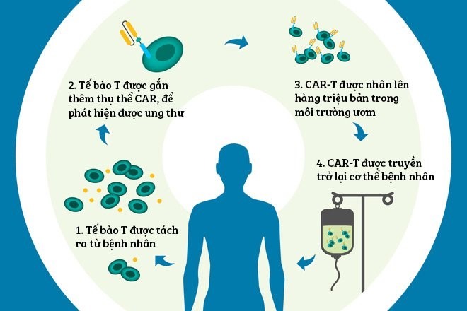 Minh họa liệu pháp tế bào CAR-T