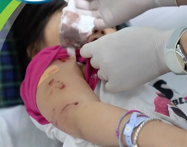 Bé gái 5 tuổi ở Hà Giang bị chó dữ lao vào tấn công khi đang đi trên vỉa hè